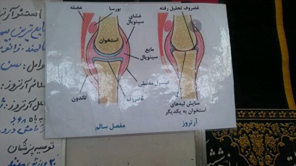 آگاه سازی معلولیتهای میانسالی و سالمندان